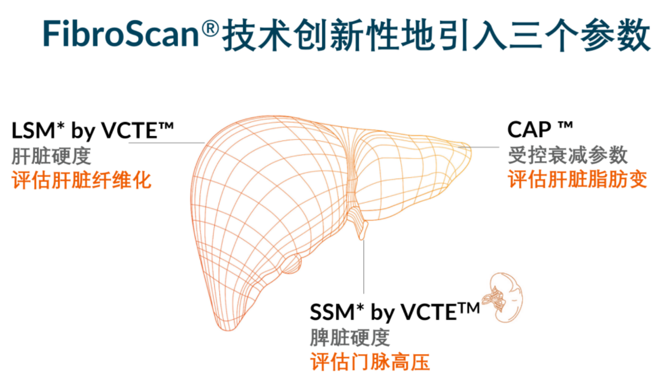 喜訊！FDA擴大了FibroScan?在肝臟綜合管理中的應(yīng)用范圍